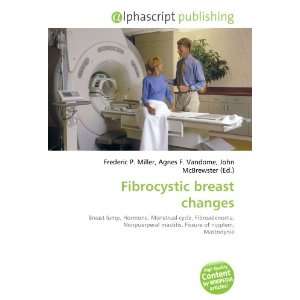  Fibrocystic breast changes (9786132709219) Books
