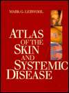   Disease, (0443087393), Mark G. Lebwohl, Textbooks   