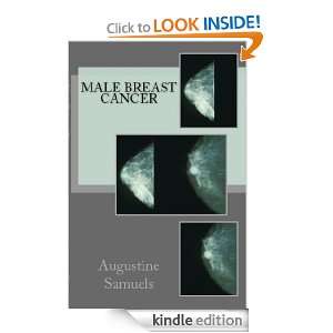   Cancer Augustine Samuels MA, M Awad MD  Kindle Store