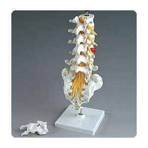  Flexible Lumbar Section with Herniated Disk   Model 928194 