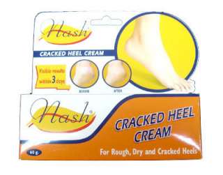 Cracked Heel Cream foot feet NASH Visible results 3 day  