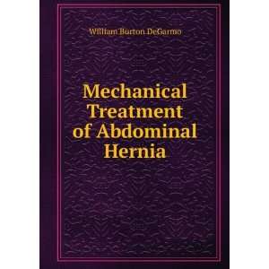  Mechanical Treatment of Abdominal Hernia William Burton 